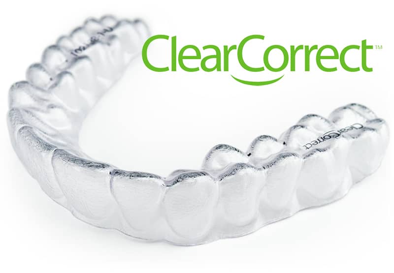 ClearCorrect aligners utilize advanced teeth straightening technology.