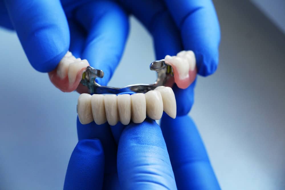  A dental bridge is a permanent restoration that fills -- or bridges -- the gap left behind by a missing tooth or teeth. 
