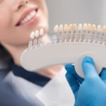 5 Pros and Cons About Porcelain Veneers