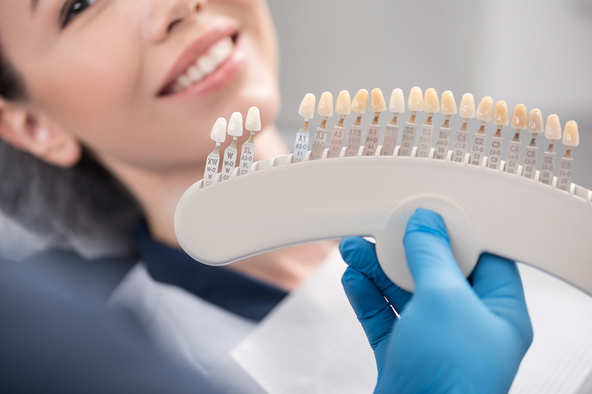 5 Pros and Cons About Porcelain Veneers