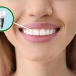 Five Facts About the Dental Implant Recovery Process