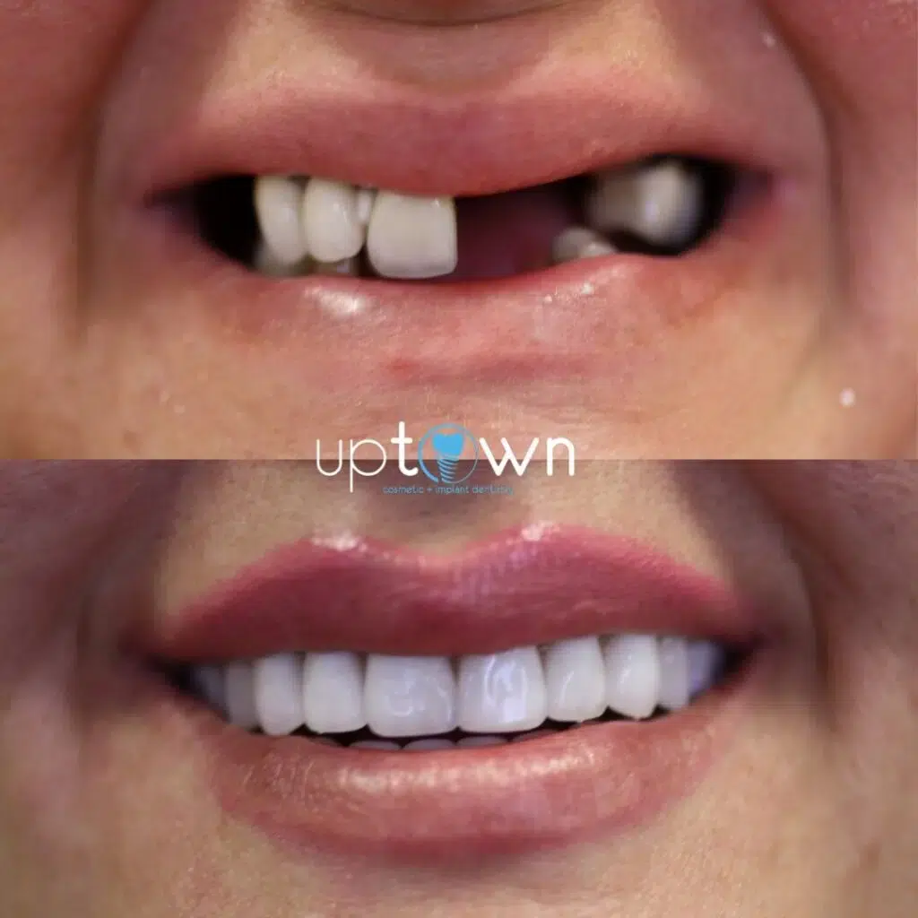 Uptown Cosmetic + Implant Dentistry